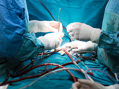 Bentall Surgery In America